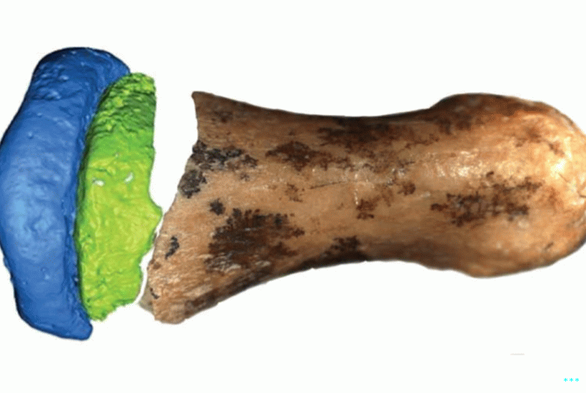 एक सफेद हड्डी पर एक उंगली की हड्डी के हिस्से की तस्वीर और बाकी के एक डिजिटल मॉडल की समग्र छवि।